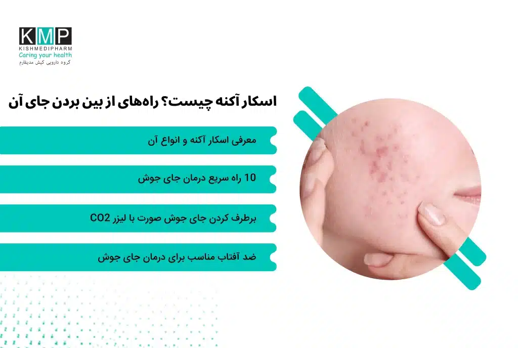 مشکلات پوستی مانند آکنه، پسوریازیس، درماتیت و اگزما از شایع‌ترین بیماری‌های پوستی هستند که گاهی پس از بهبود، آثاری روی پوست باقی می‌گذارند. یکی از مهم‌ترین این آثار، اسکار آکنه است که در نتیجه اختلال در فرآیند ترمیم و کلاژن‌سازی پوست ایجاد می‌شود. اگر تولید کلاژن کم باشد، فرورفتگی و اگر بیش از حد باشد، برجستگی روی پوست ایجاد می‌شود. اسکارهای آکنه انواع مختلفی دارند؛ از جمله اسکارهای فرورفته مانند آیس‌پیک و جعبه‌ای، اسکارهای موج‌دار (غلتکی)، اسکارهای برجسته مانند هایپرتروفیک و کلوئیدی و لک‌های تیره پس از التهاب. شدت آن‌ها نیز از خفیف تا شدید متغیر است و انتخاب روش درمان به نوع و عمق اسکار بستگی دارد. برای پیشگیری از ایجاد جای جوش باید از دستکاری آکنه خودداری کرد، درمان مناسب هر نوع جوش را انجام داد، از ضدآفتاب استفاده کرد و رسیدگی درمانی را به تعویق نینداخت. روش‌های درمان جای جوش شامل درمان‌های غیرتهاجمی مانند استفاده از سالیسیلیک اسید، رتینوئیدها، آلفا هیدروکسی اسید، ضدآفتاب مناسب و ترکیبات روشن‌کننده و همچنین روش‌های تخصصی مانند لیزر CO2، میکرونیدلینگ، تزریق فیلر، تزریق کورتیکواستروئید، لایه‌برداری شیمیایی، درم‌ابریژن و جراحی پانچ هستند. انتخاب روش درمان باید توسط پزشک متخصص و بر اساس نوع اسکار انجام شود. علاوه بر این، برخی راهکارهای خانگی مانند استفاده از محصولات حاوی آزالیک اسید، نیاسینامید، رتینول، ویتامین C و ژل‌های سیلیکونی می‌توانند در کاهش لک و بهبود ظاهر اسکارهای خفیف مؤثر باشند. در نهایت، پیشگیری و درمان به‌موقع بهترین راه برای جلوگیری از ماندگاری جای جوش است.