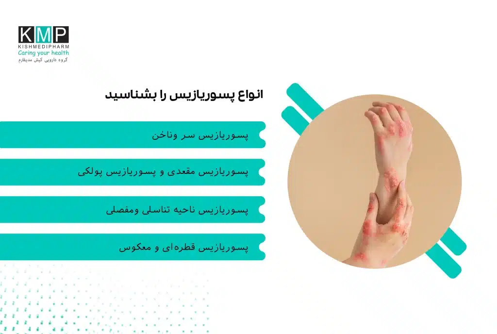 اینفوگرافیک جامع از انواع پسوریازیس شامل پسوریازیس پلاکی، سر، ناخن، مفصلی، تناسلی، معکوس، قطرهای، پوسچولار و اریترودرمی با نمایش نواحی درگیر بدن.