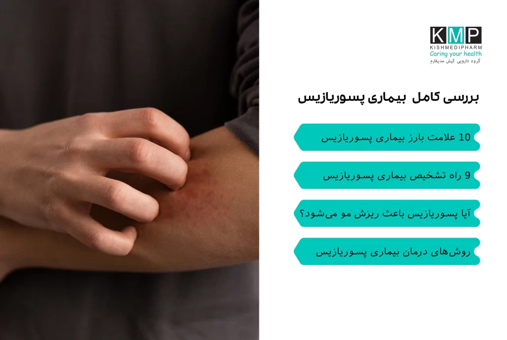 تصویری از پوست سر ملتهب و قرمز با پلاکهای فلسدار، همراه با شامپو و لوسیونهای درمانی مخصوص پسوریازیس سر.