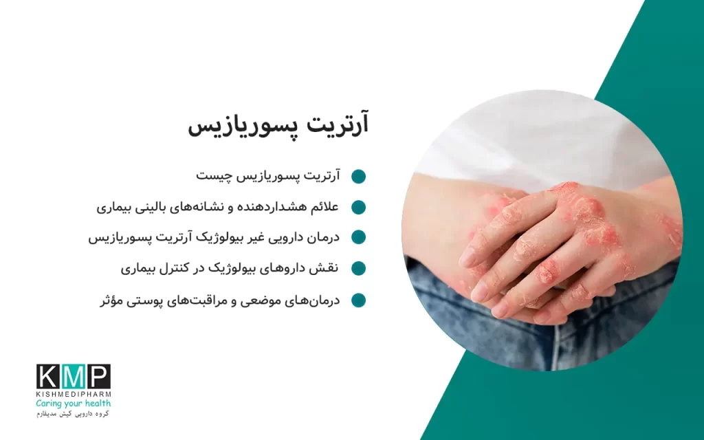 آرتریت پسوریازیس یک بیماری خودایمنی است که هم پوست و هم مفاصل را درگیر میکند. درد، تورم، خشکی مفاصل و ضایعات پوستی از نشانههای اصلی آن هستند. درمان این بیماری نیازمند ترکیبی از داروهای بیولوژیک، داروهای غیر بیولوژیک، درمانهای موضعی و تغییر سبک زندگی است. تشخیص زودهنگام و مراقبت منظم میتواند از آسیب غیرقابل بازگشت مفاصل جلوگیری کند.