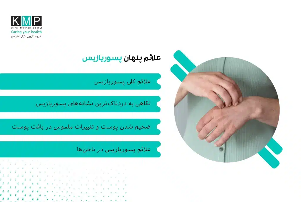 پسوریازیس یک بیماری مزمن و التهابی با منشأ خودایمنی است که تنها به پوست محدود نمیشود و میتواند ناخنها، مفاصل و حتی وضعیت روانی فرد را درگیر کند. این بیماری با علائمی مانند لکههای قرمز و پوستهدار، خارش، ضخیم شدن و ترکخوردگی پوست آغاز میشود و در برخی افراد به درد و التهاب مفاصل، خستگی مزمن و مشکلات سیستمیک منجر میگردد. تنوع و پیچیدگی علائم پسوریازیس باعث میشود تشخیص بهموقع آن نقش تعیینکنندهای در کنترل بیماری، پیشگیری از عوارض و بهبود کیفیت زندگی بیمار داشته باشد.