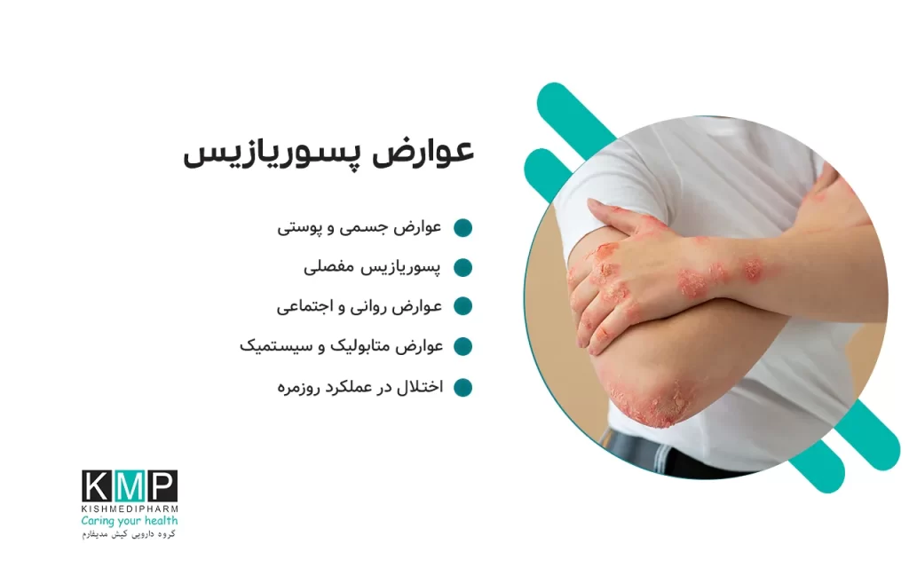 پسوریازیس بیماری مزمن پوستی است که می‌تواند باعث خارش، قرمزی و پوسته‌ریزی شود. پماد کلوبتازول یکی از قوی‌ترین درمان‌های موضعی است که با کاهش التهاب و کنترل تکثیر سلول‌های پوست، علائم را سریعاً تسکین می‌دهد. پسوریازیس یک بیماری پوستی است که باعث خارش، التهاب و پوسته‌ریزی می‌شود. پماد کلوبتازول به‌عنوان یک داروی قوی موضعی، به کاهش سریع این علائم کمک می‌کند. با این حال، استفاده طولانی‌مدت یا روی پوست حساس می‌تواند آسیب‌زا باشد. کنار دارو، مراقبت روزانه از پوست، رژیم غذایی سالم و کاهش استرس می‌تواند روند بهبود را سرعت دهد و زندگی روزمره را راحت‌تر کند.