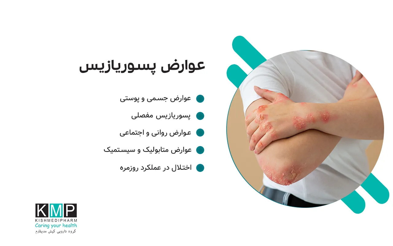 پسوریازیس بیماری مزمن پوستی است که می‌تواند باعث خارش، قرمزی و پوسته‌ریزی شود. پماد کلوبتازول یکی از قوی‌ترین درمان‌های موضعی است که با کاهش التهاب و کنترل تکثیر سلول‌های پوست، علائم را سریعاً تسکین می‌دهد. پسوریازیس یک بیماری پوستی است که باعث خارش، التهاب و پوسته‌ریزی می‌شود. پماد کلوبتازول به‌عنوان یک داروی قوی موضعی، به کاهش سریع این علائم کمک می‌کند. با این حال، استفاده طولانی‌مدت یا روی پوست حساس می‌تواند آسیب‌زا باشد. کنار دارو، مراقبت روزانه از پوست، رژیم غذایی سالم و کاهش استرس می‌تواند روند بهبود را سرعت دهد و زندگی روزمره را راحت‌تر کند.