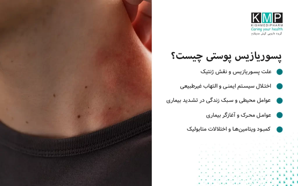 پسوریازیس یک بیماری التهابی مزمن پوست است که بر اثر ترکیبی از عوامل ژنتیکی، اختلال سیستم ایمنی، استرس، عفونتها، تغییرات هورمونی و سبک زندگی ناسالم ایجاد میشود. در این بیماری، سلولهای پوست با سرعتی غیرطبیعی رشد کرده و ضایعات قرمز، پوستهپوسته و خارشدار ایجاد میشوند. مراقبت از پوست، مدیریت استرس، خواب کافی، تغذیه سالم و درمان دارویی میتوانند به کنترل بیماری کمک کنند.