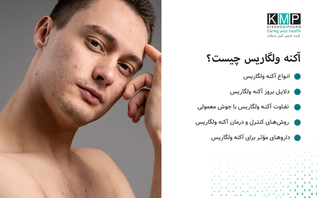 آکنه ولگاریس یک بیماری التهابی پوستی شایع است که باعث ایجاد جوش، کومدون، پاپول، پوسچول، ندول و کیست میشود.