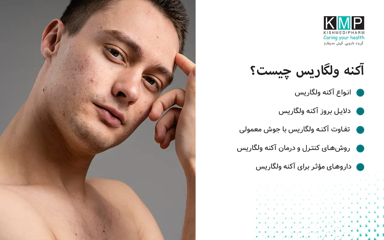 آکنه ولگاریس یک بیماری التهابی پوستی شایع است که باعث ایجاد جوش، کومدون، پاپول، پوسچول، ندول و کیست می‌شود.