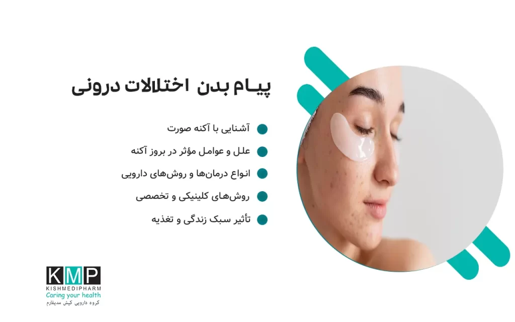 آکنه صورت یک اختلال پوستی شایع و التهابی است که میتواند ناشی از عوامل هورمونی، ژنتیکی، سبک زندگی یا تغذیه باشد. درمان آن شامل مراقبتهای خانگی، داروهای موضعی و سیستمیک، لیزر و تغییر سبک زندگی است.