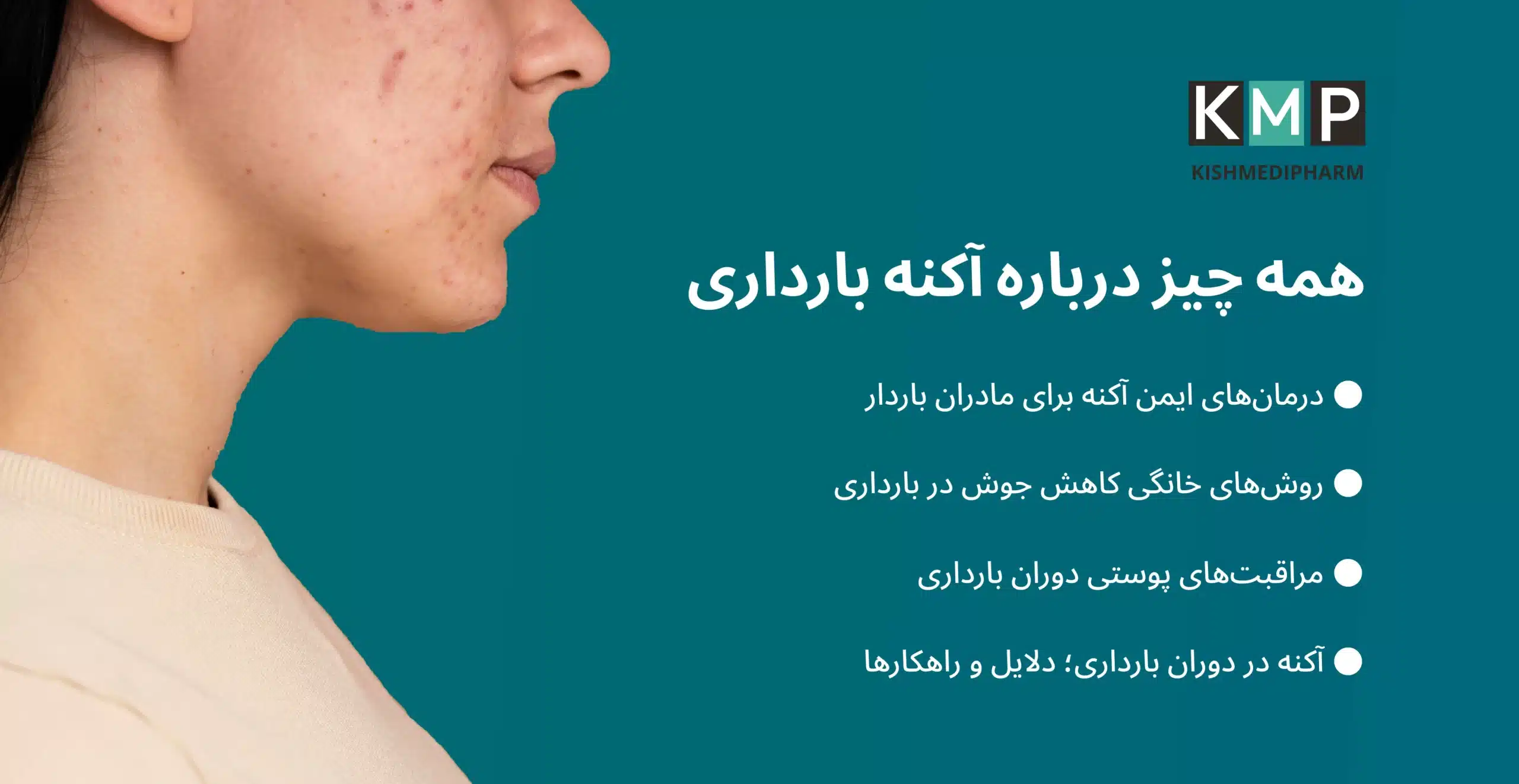 آکنه در بارداری: علت‌ها، درمان‌های ایمن و هر آنچه باید بدانید