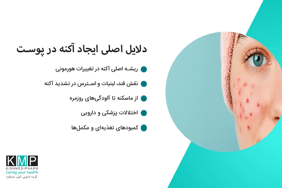 علت آکنه و ارتباط آن با اختلالات هورمونی، تغذیه، استرس و سلامت درونی بدن