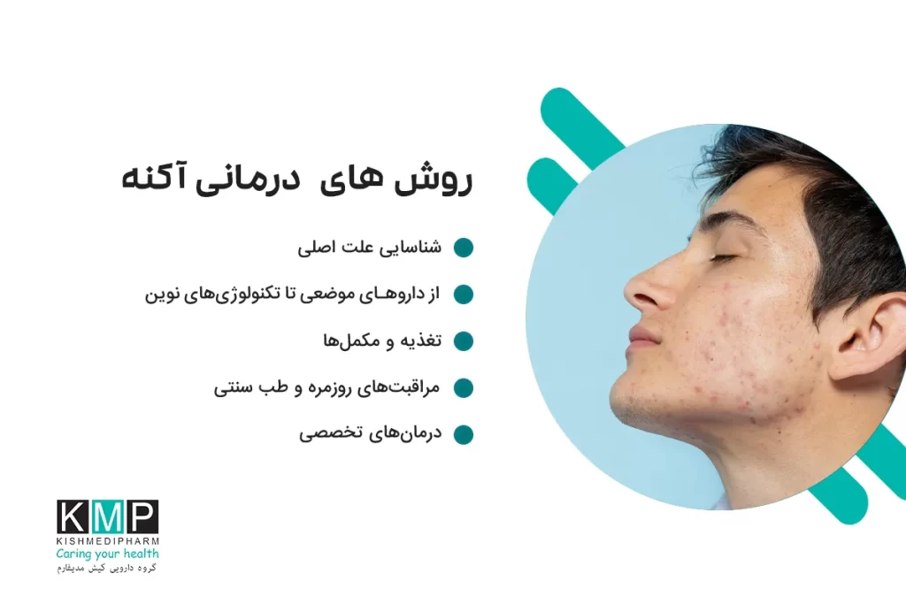 بازنویسی حرفهای و یکپارچه (نسخه نهایی مقاله – خوانا، منسجم و سئوپسند) آکنه یکی از شایعترین و در عین حال پیچیدهترین مشکلات پوستی است که برخلاف تصور عمومی، درمان آن همیشه ساده و یکسان نیست. بسیاری از افراد با این پرسش مواجهاند که درمان آکنه چیست و چرا برخی روشها برای یک فرد مؤثر و برای دیگری بینتیجه است. واقعیت این است که آکنه میتواند دلایل متعددی از جمله اختلالات هورمونی، سبک زندگی، تغذیه نامناسب، التهابهای مزمن، عوامل ژنتیکی و حتی استرس داشته باشد. درمان مؤثر آکنه، مستلزم شناسایی دقیق علت بروز آن است. بدون شناخت ریشه مشکل، درمانها اغلب موقتی خواهند بود. به همین دلیل، رویکردی جامع که همزمان به درمانهای موضعی، اصلاح رژیم غذایی، مراقبتهای پوستی، مکملها، طب سنتی و تکنولوژیهای نوین پزشکی توجه دارد، بهترین نتایج را به همراه خواهد داشت. از اصلاح عادتهای روزمره و شستوشوی اصولی صورت گرفته تا استفاده از ضدآفتاب، تونرهای گیاهی، مکملهای غذایی و درمانهای تخصصی مانند لیزر، هر کدام نقش مکملی در مسیر درمان سریع آکنه ایفا میکنند. همچنین در موارد خاص مانند آکنه قارچی، کیستیک یا هورمونی، تشخیص صحیح و انتخاب درمان هدفمند اهمیت دوچندان دارد. آکنه یکی از شایعترین و در عین حال پیچیدهترین مشکلات پوستی است که درمان آن نیازمند رویکردی چندبعدی و علمی میباشد. از شناسایی علتهای هورمونی و تغذیهای گرفته تا استفاده از درمانهای دارویی، گیاهی و تکنولوژیهای نوین پزشکی، هر کدام نقش مهمی در کنترل و درمان آکنه ایفا میکنند. این مقاله با نگاهی جامع، تمام روشهای مؤثر درمان آکنه، از درمانهای خانگی و طب سنتی تا داروهای ترکیبی و روشهای پیشرفته کلینیکی را بررسی میکند تا مسیر درمانی آگاهانهتری پیش روی شما قرار دهد.