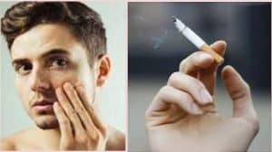 تصویری که در سمت راست فرد سیگار میکشد و در سمت چپ مشغول بررسی جوشهای خود در آینه است