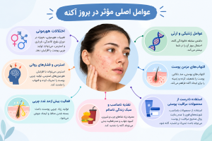 عوامل مؤثر در بروز آکنه شامل اختلالات هورمونی، ژنتیک، استرس، چربی بیشازحد پوست و مراقبت نادرست پوستی